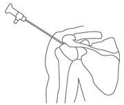 doctores-traumatologia-y-ortopedia-en-atizapan-mexico