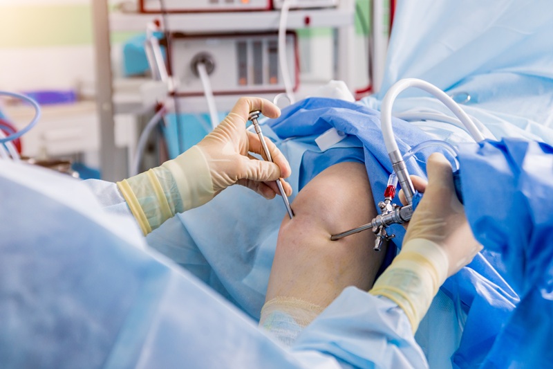 Artroscopia de rodilla